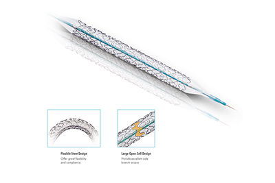 Stents_H-Stent_s
